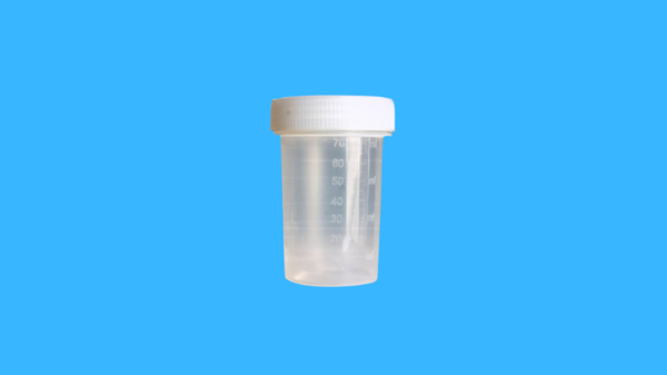 Urine Culture Bottle